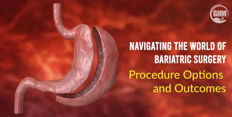 Navigating-the-World-of-Bariatric-Surgery--Procedure-Options-and-Outcomes
