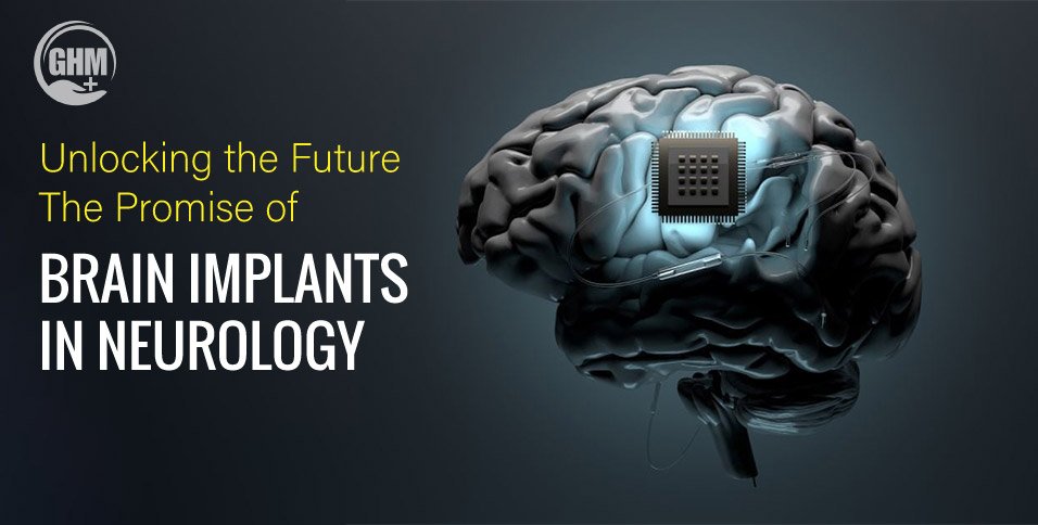 Unlocking-the-Future-The-Promise-of-Brain-Implants-in-Neurology