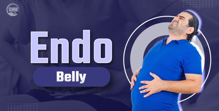 Endo Belly