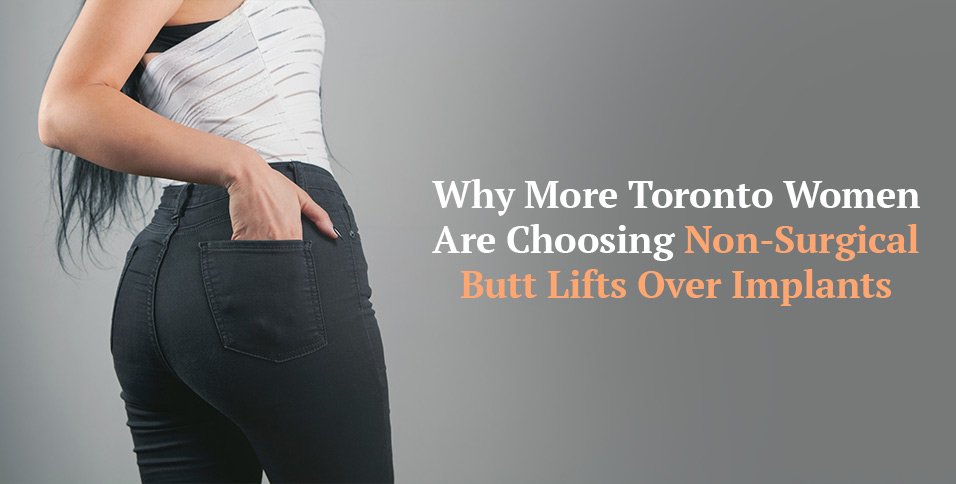 Non-Surgical Butt Lifts