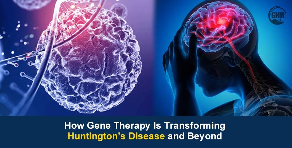 Huntington’s Disease