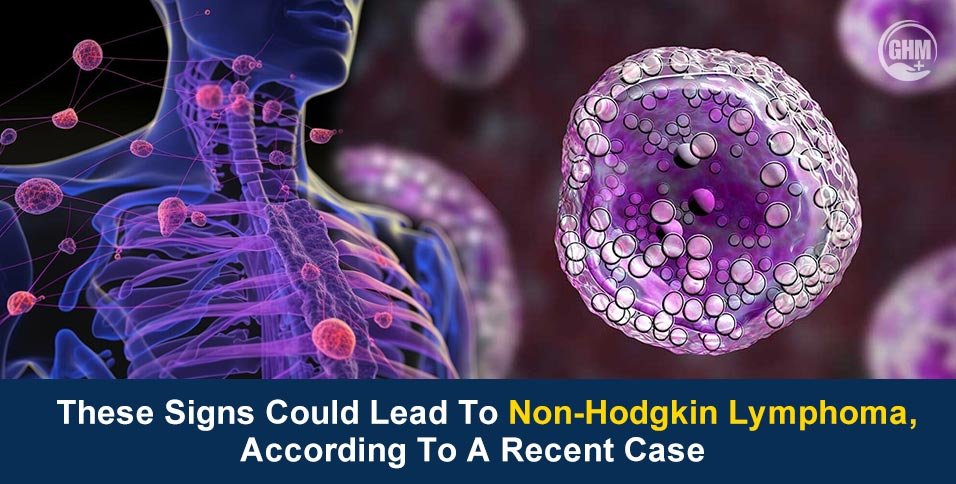 Non-Hodgkin Lymphoma