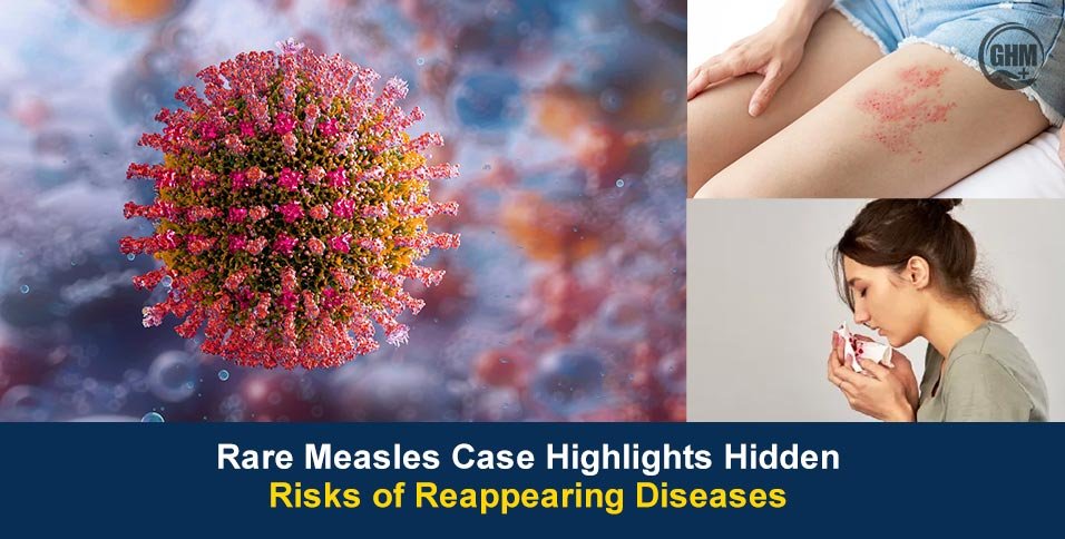 Risks of Recurring Diseases