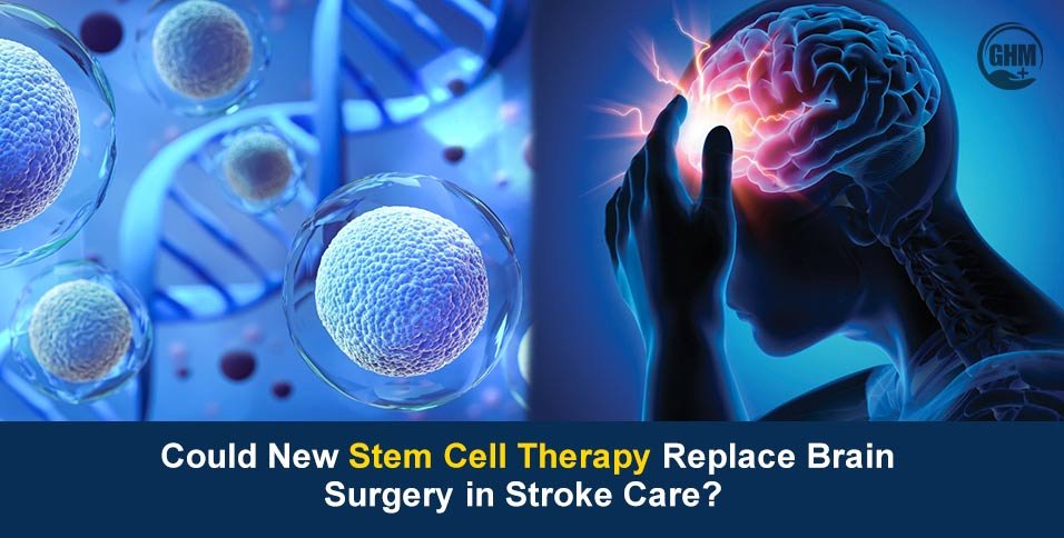 stem cell therapy