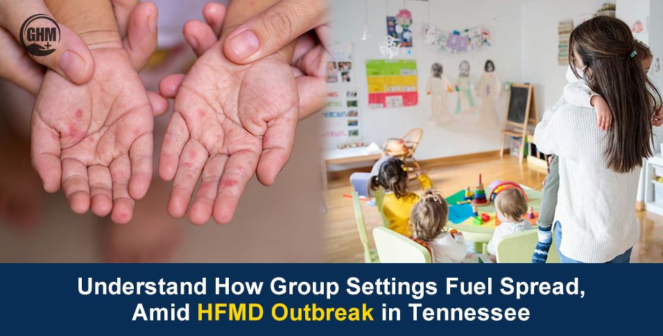 HFMD Outbreak