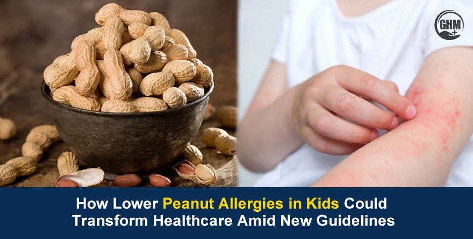 Peanut Allergies in Kids
