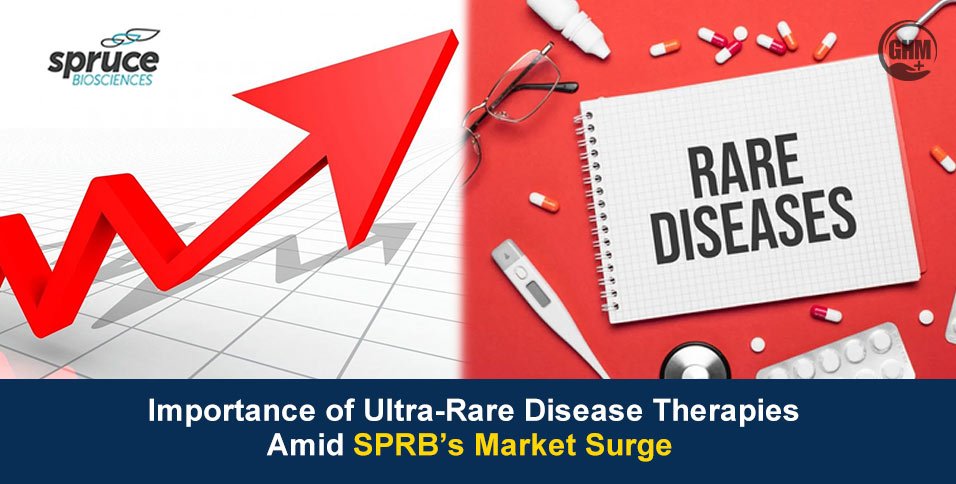 SPRB’s Market Surge