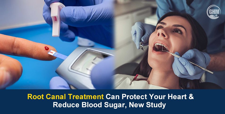 Root Canal Treatment