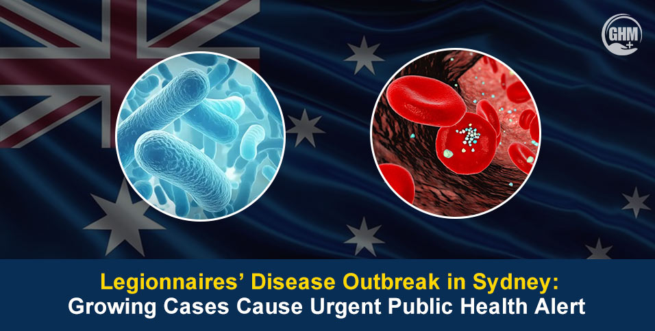 Legionnaires’ Disease Outbreak in Sydney