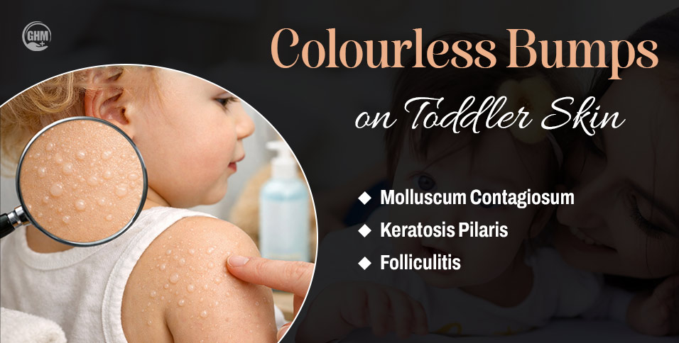 Colourless Bumps on Toddler Skin
