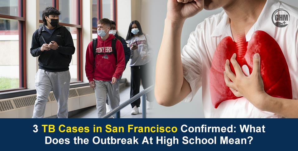 3 TB Cases in San Francisco Confirmed: What Does the Outbreak At High School Mean?