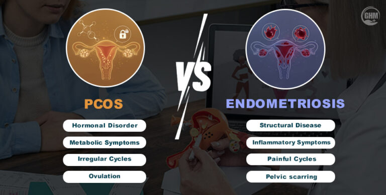 PCOS vs. Endometriosis: 8 Key Differences Every Woman Should Know