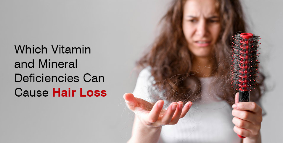 Which Vitamin and Mineral Deficiencies Can Cause Hair Loss