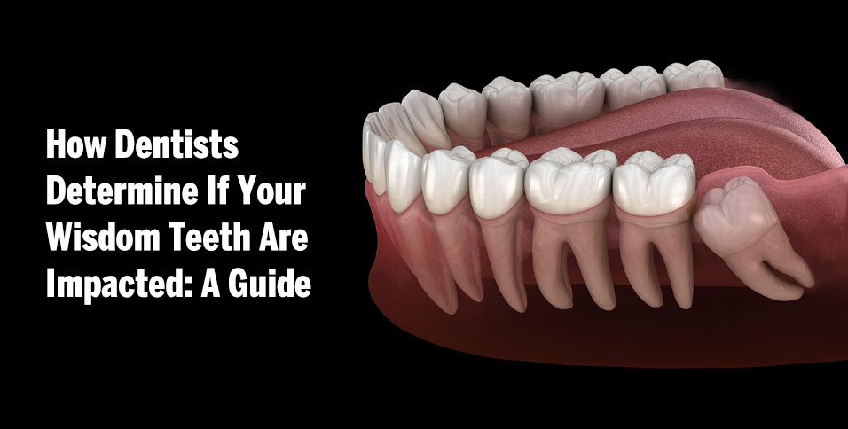 How Dentists Determine If Your Wisdom Teeth Are Impacted: A Guide
