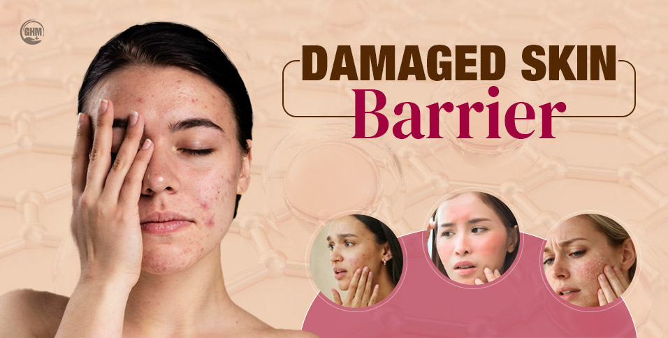 Damaged Skin Barrier: Signs, Causes & How to Repair It
