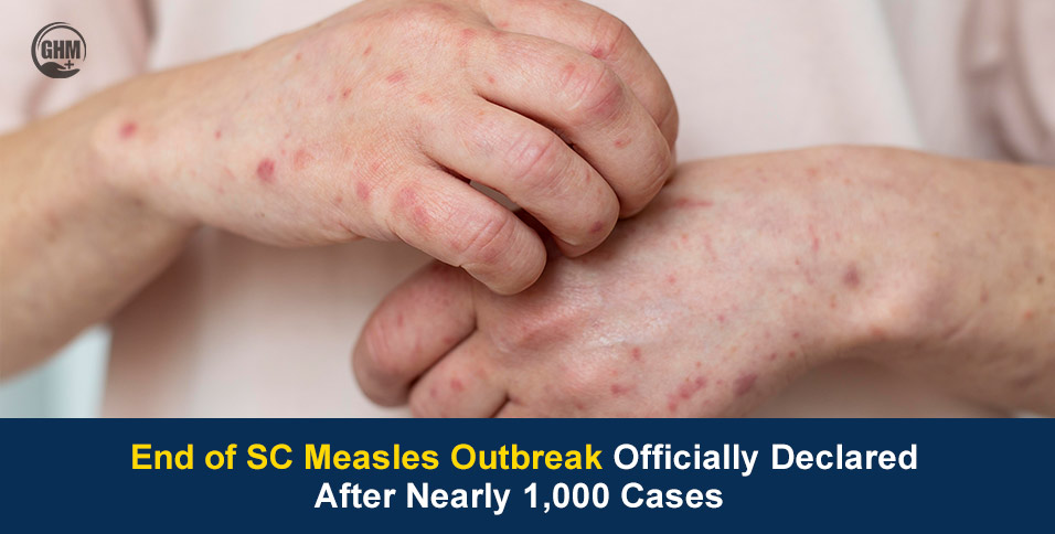 End of SC Measles Outbreak