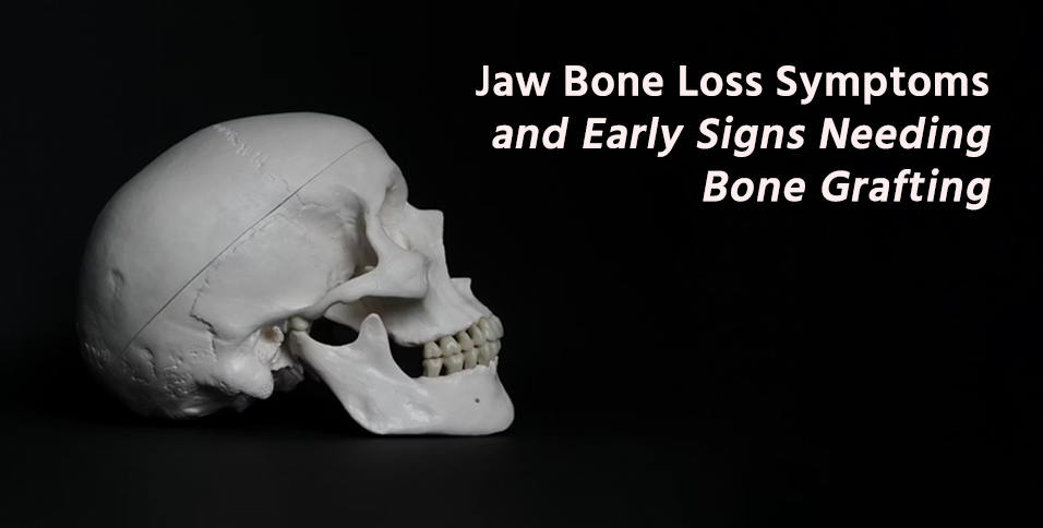 Jaw Bone Loss Symptoms and Early Signs Needing Bone Grafting
