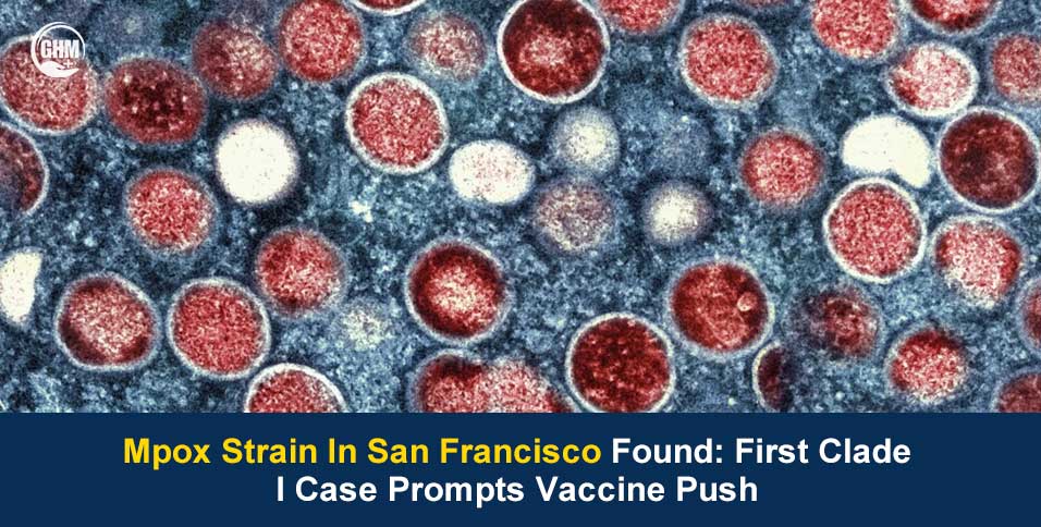 A New Mpox strain in San Francisco Sparks Vaccine Alert