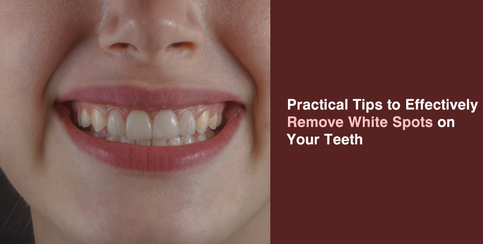 Practical Tips to Effectively Remove White Spots on Your Teeth