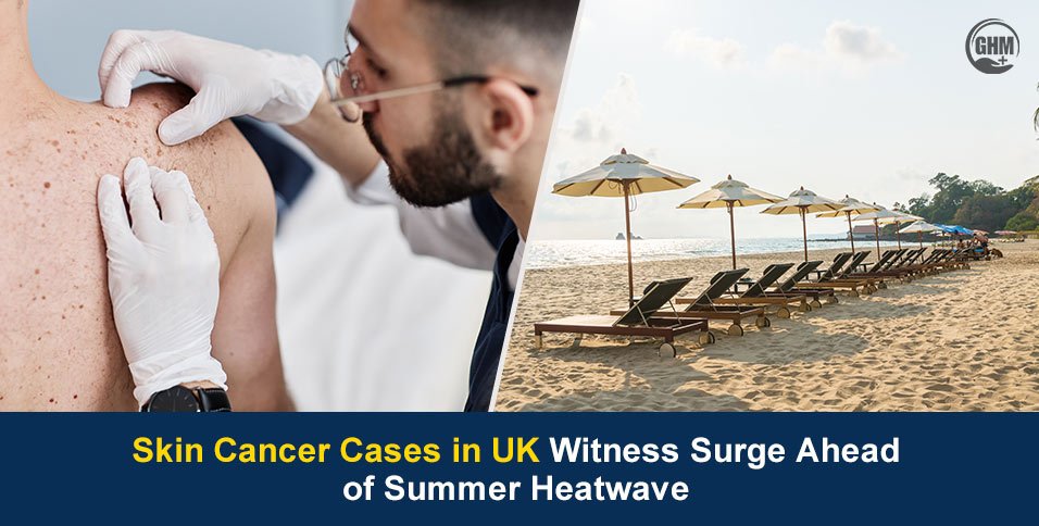 Skin Cancer Cases in UK