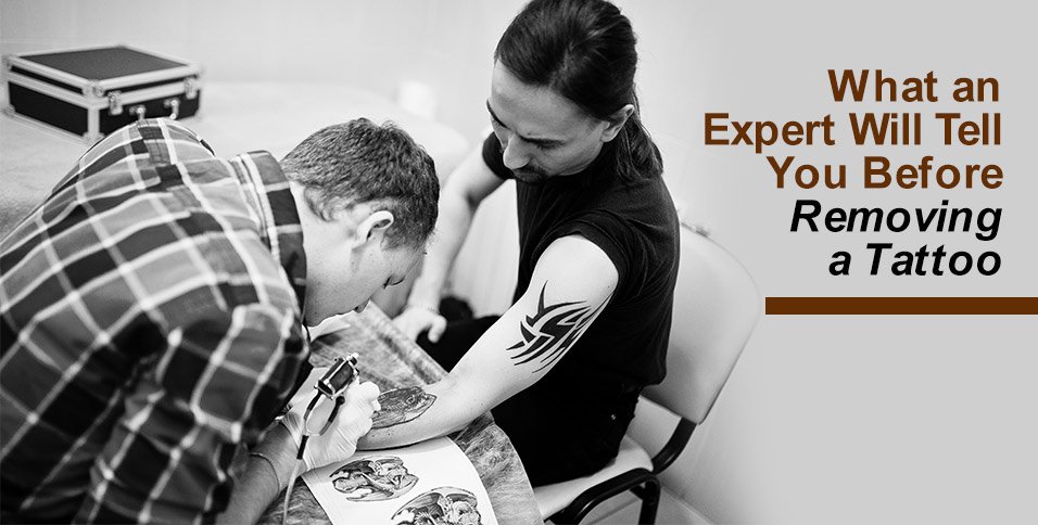 What an Expert Will Tell You Before Removing a Tattoo