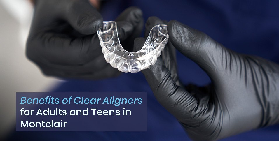Benefits of Clear Aligners for Adults and Teens in Montclair