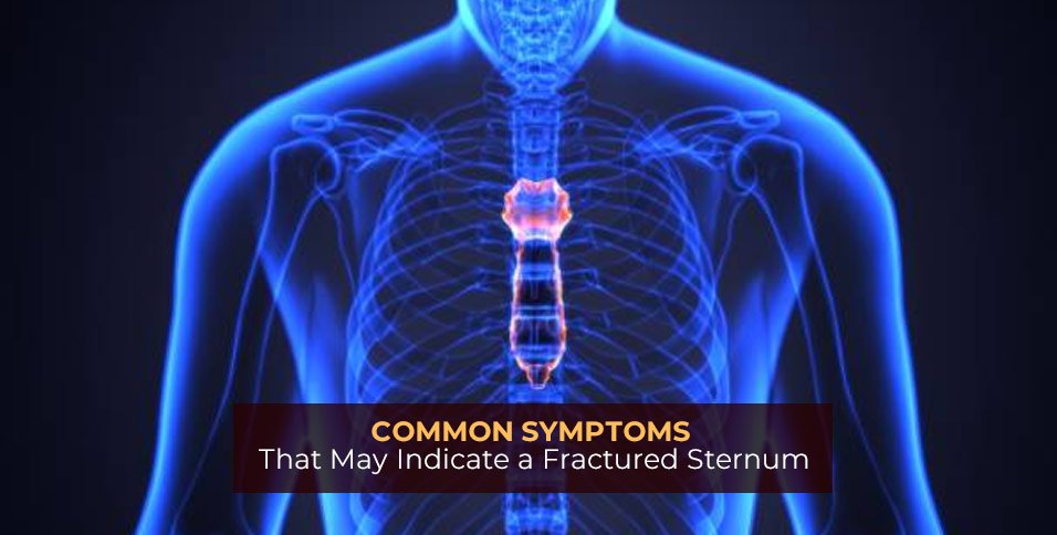 Common Symptoms That May Indicate a Fractured Sternum