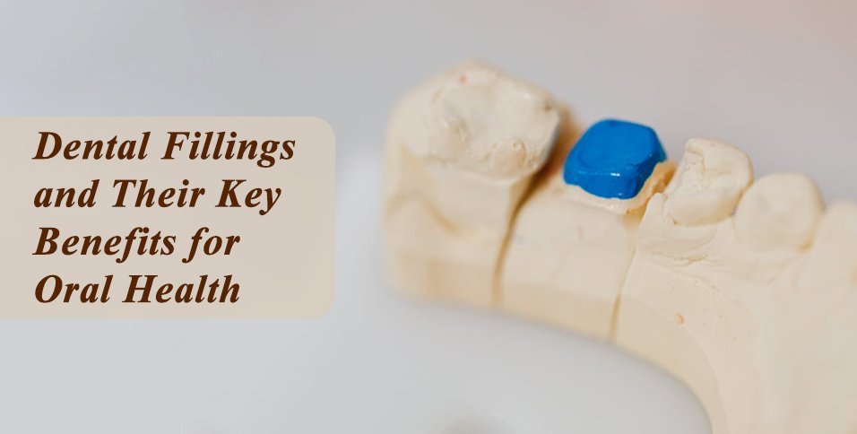 Dental Fillings and Their Key Benefits for Oral Health