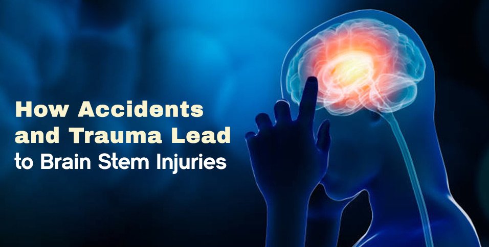 How Accidents and Trauma Lead to Brain Stem Injuries