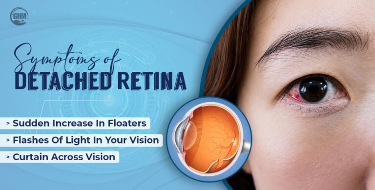 5 Symptoms of Detached Retina: Recognize the Early Signs Before It’s Too Late