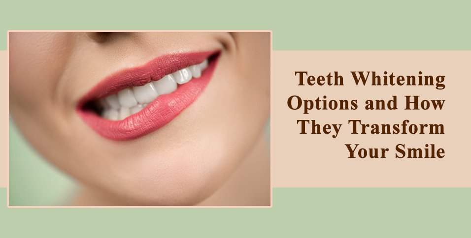 Teeth Whitening Options and How They Transform Your Smile