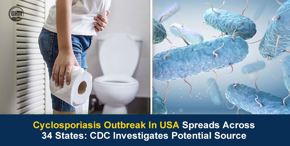 Cyclosporiasis Outbreak in USA Spreads Across 34 States