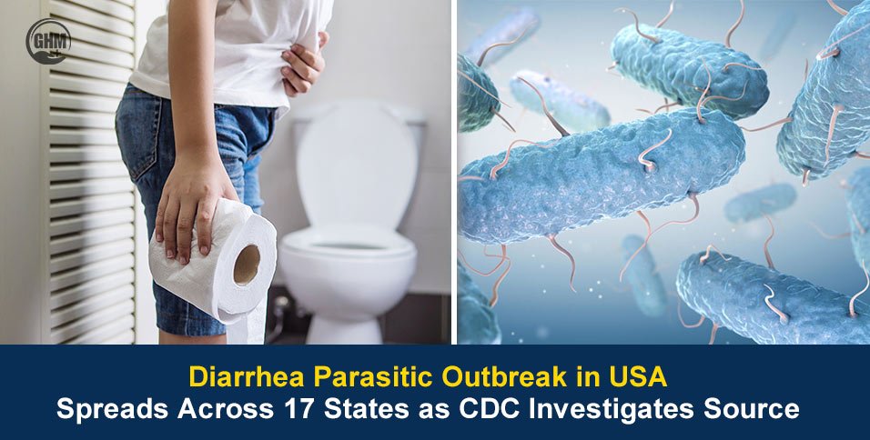Diarrhea Parasitic Outbreak in USA Spreads Across 17 States as CDC Investigates Source