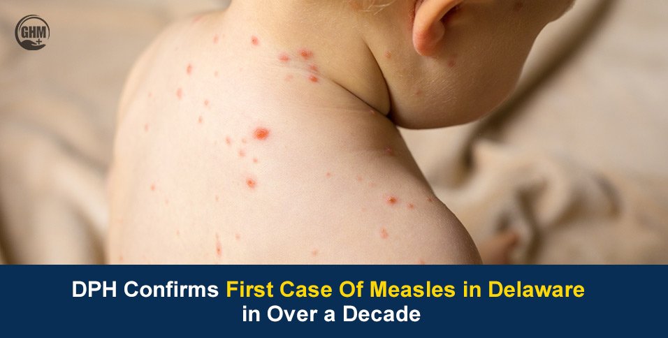 DPH Confirms First Case Of Measles in Delaware in Over a Decade
