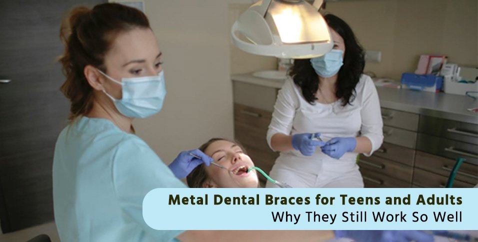 Metal Dental Braces for Teens and Adults: Why They Still Work So Well