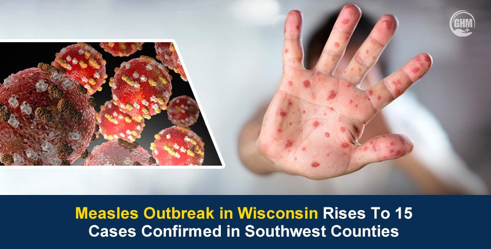 Measles Outbreak in Wisconsin