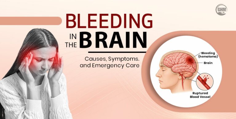 Bleeding-In-The-Brain