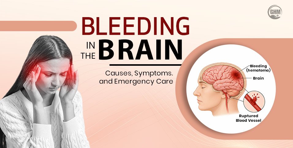 Bleeding-In-The-Brain