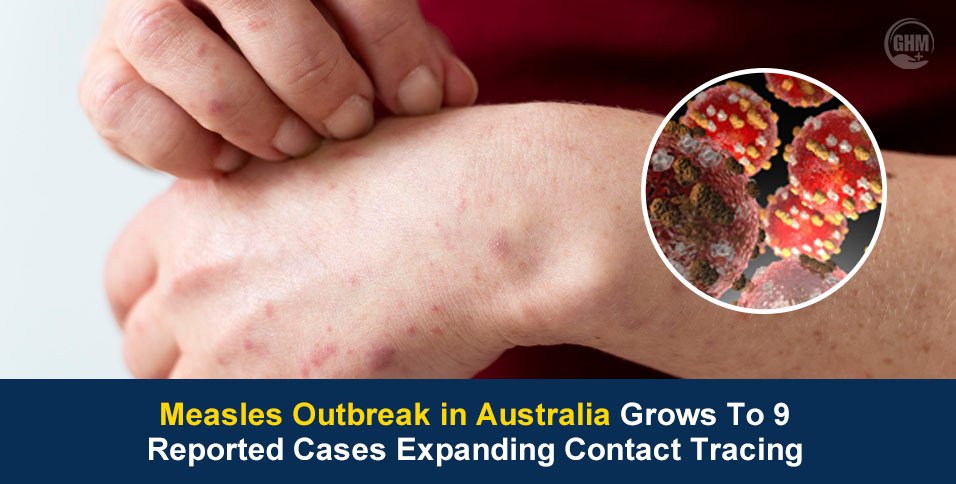 Measles Outbreak in Australia Grows To 9 Reported Cases Expanding Contact Tracing