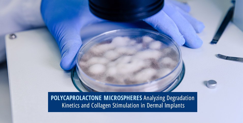 Polycaprolactone Microspheres: Analyzing Degradation Kinetics and Collagen Stimulation in Dermal Implants