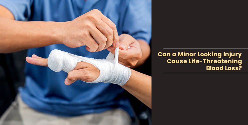 Can a Minor Looking Injury Cause Life-Threatening Blood Loss?