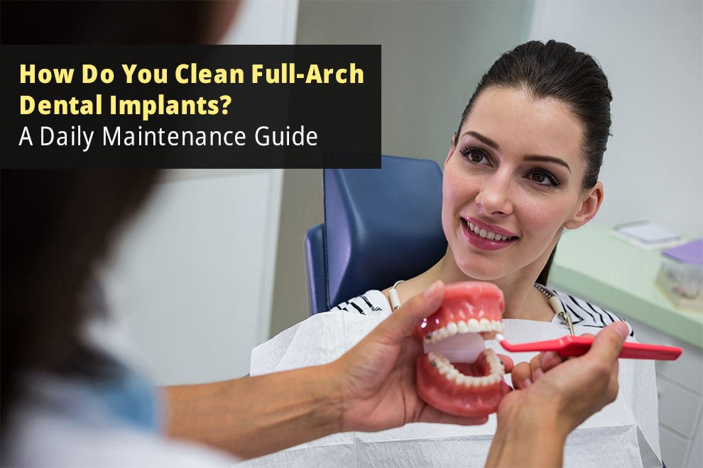 How Do You Clean Full-Arch Dental Implants? A Daily Maintenance Guide