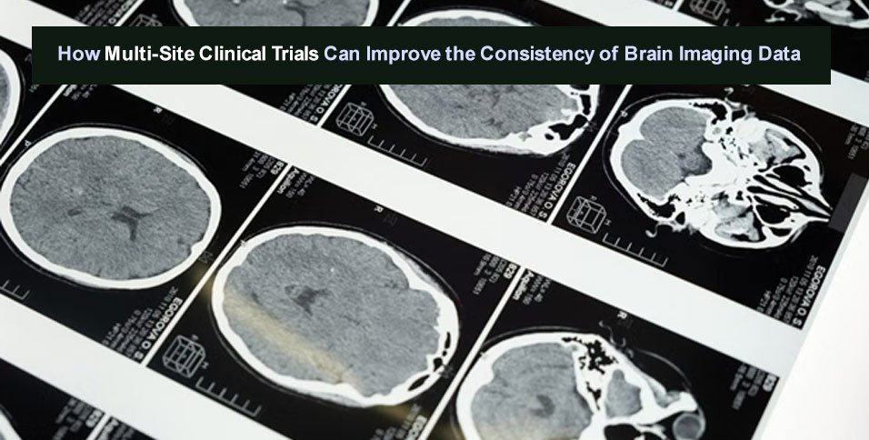 How Multi-Site Clinical Trials Can Improve the Consistency of Brain Imaging Data