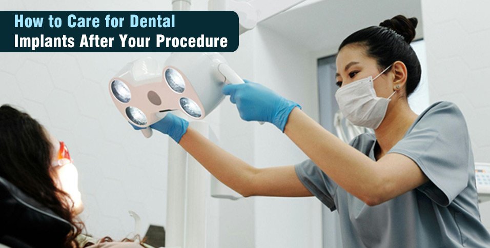 How to Care for Dental Implants After Your Procedure