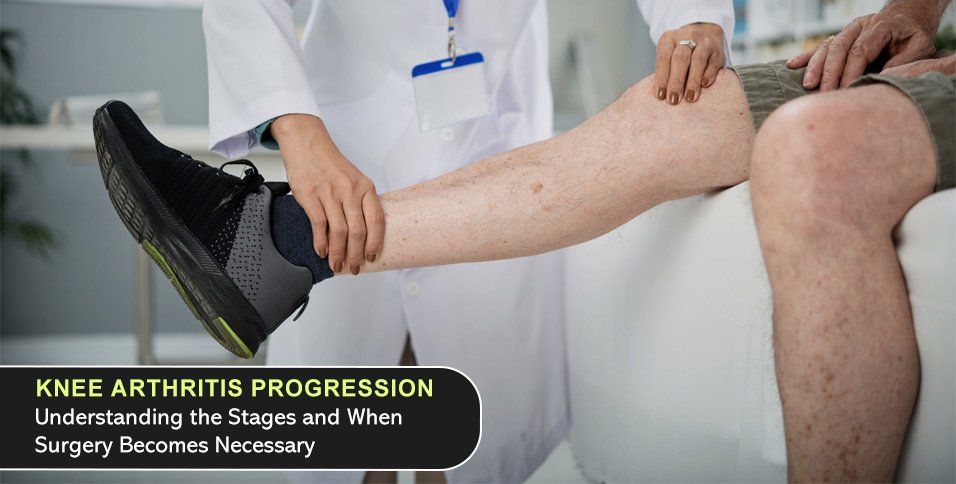 Knee Arthritis Progression: Understanding the Stages and When Surgery Becomes Necessary