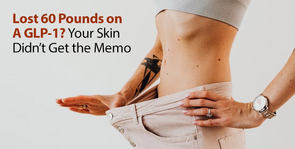 Lost 60 Pounds on a GLP-1? Your Skin Didn’t Get the Memo