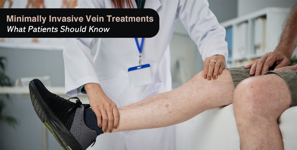 Minimally Invasive Vein Treatments: What Patients Should Know