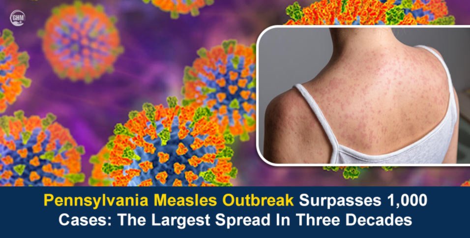 Pennsylvania Measles Outbreak Surpasses 1,000 Cases: The Largest Spread In Three Decades
